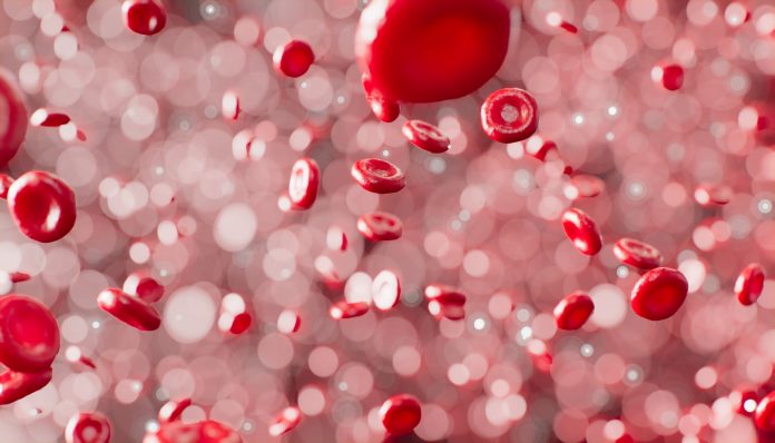 Anemia Bukan Darah Rendah Anemia Bukan Darah Rendah